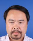 After Hair Transplant &nbsp;Front
